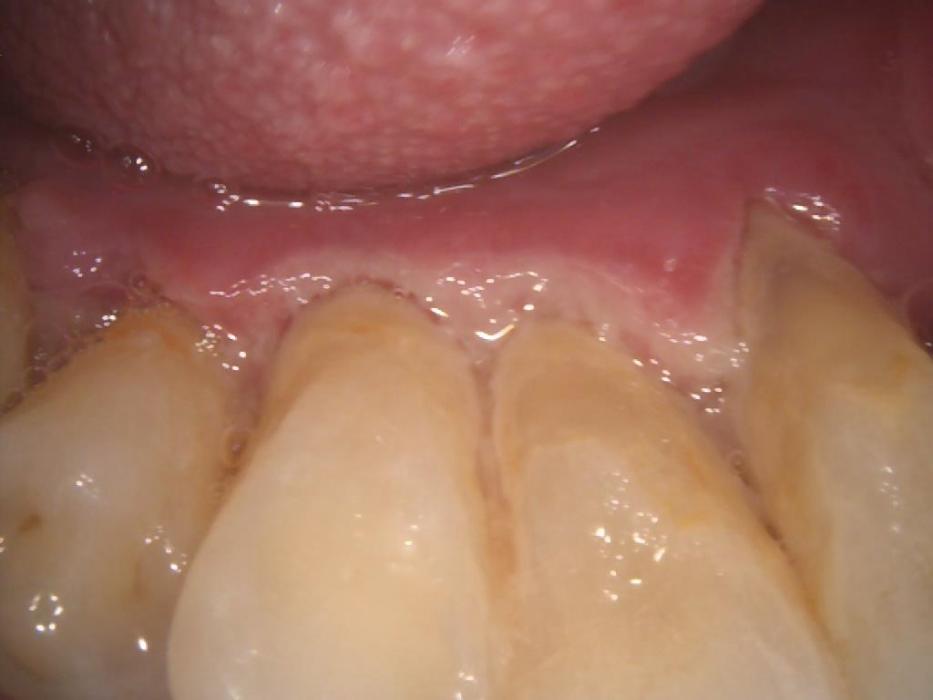 Oral Health