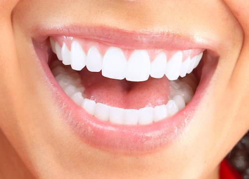 Close up of smile | Dentist pascoe vale vic