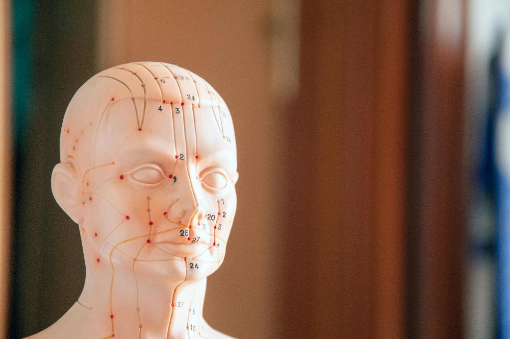 Head with acupuncture points on it, pascoe vale