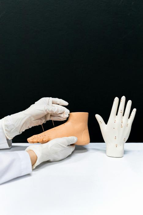 Dummy hand and foot being used for acupuncture practice, pascoe vale