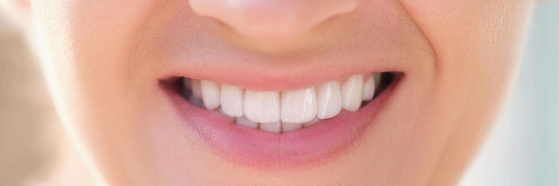 Close up of a mouth, pascoe vale vic