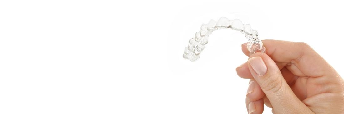 clear aligners | glenroy orthodontics