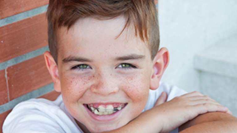 Orthodontic 