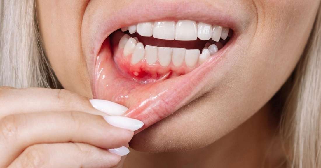Teeth and Gum Health