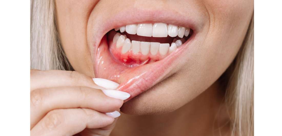 Oral Health Importance in Pregnancy