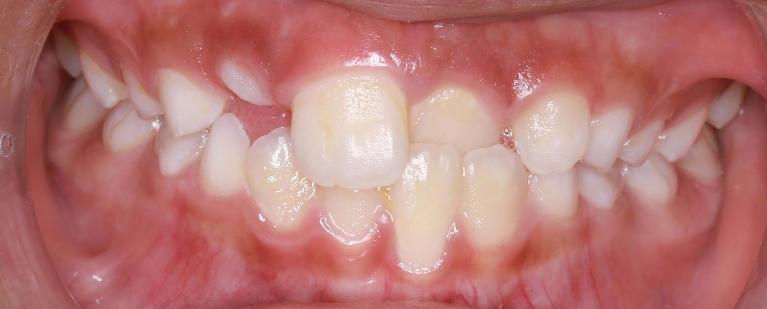 Active-Removable-Appliance-Before-Image